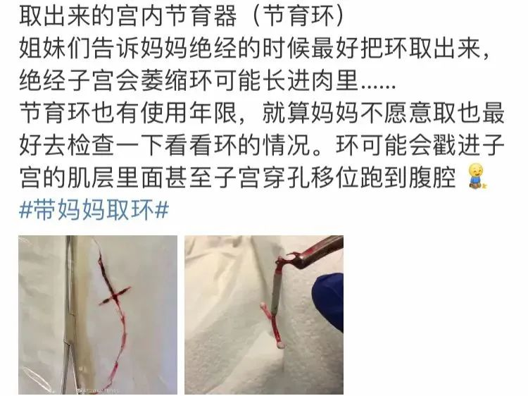 “哺乳期上环擦边女”：情色play的狂欢，太恶心了！